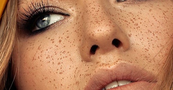 10 Prominente, die eine Nasenkorrektur hatten – und warum das kein Tabu sein sollte